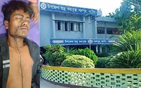 লালপুরে এসিড নিক্ষেপে যুবকের মুখমন্ডল ঝলসে দিল দুর্বৃত্তরা