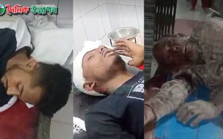 নাটোরে সড়ক দুর্ঘটনায় আহত ৩